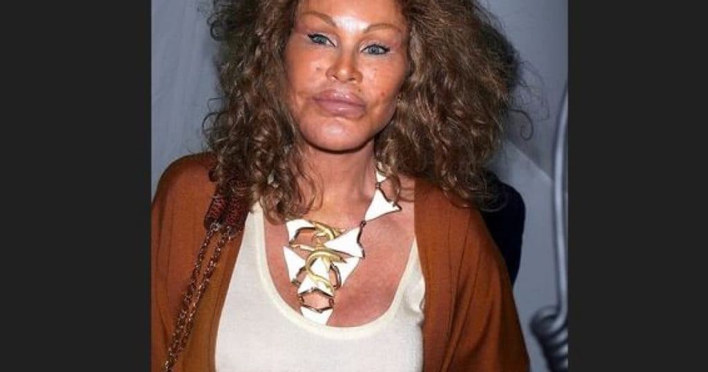 A decedat „Catwoman”. Jocelyn Wildenstein era cunoscută pentru intervențiile chirurgicale estetice extreme.
