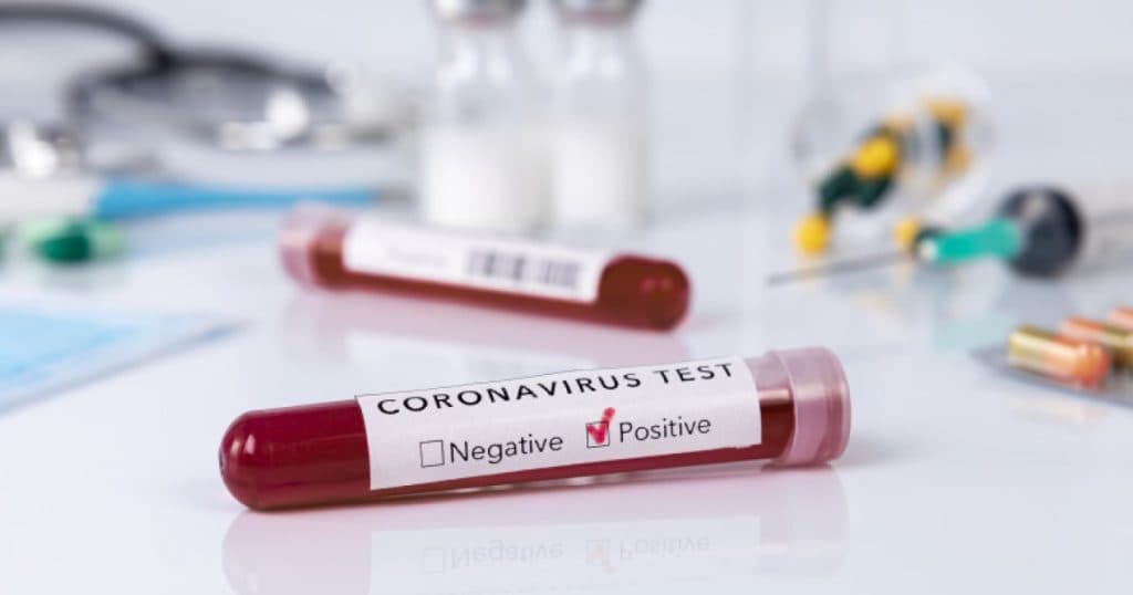 CIA: Este „mai probabil” ca pandemia de COVID-19 să fi avut origine într-un laborator și nu în natură