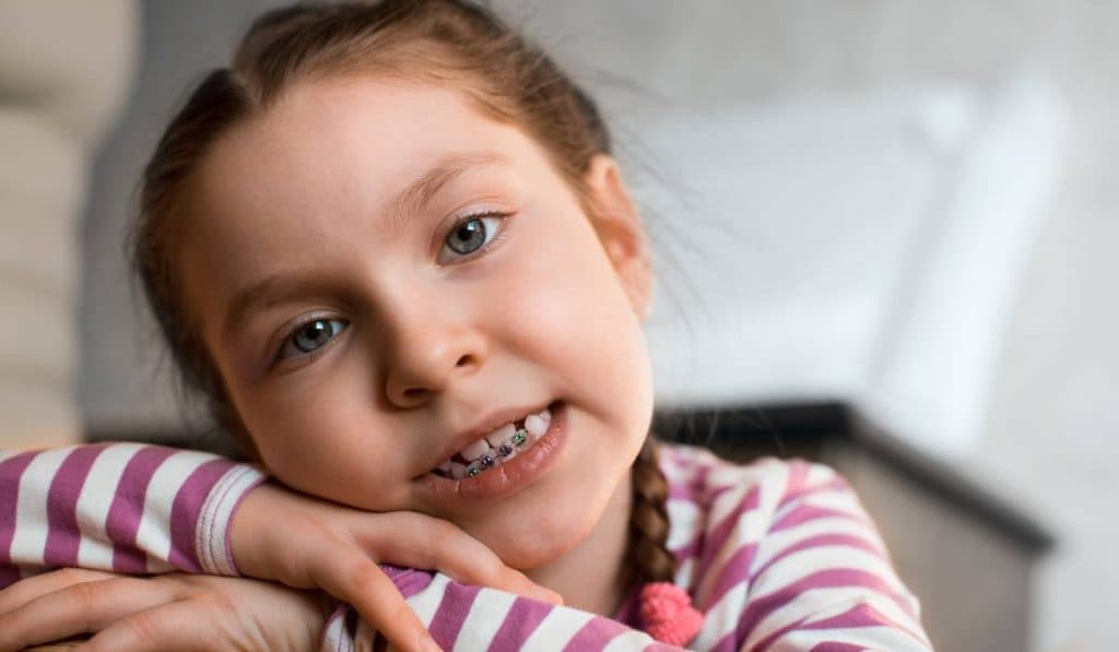 Cum să pregătești copilul pentru primul aparat dentar: ghid concis pentru părinți
