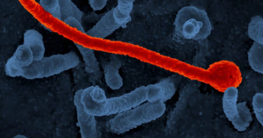 Epidemie de Ebola în estul Africii: un focar de îmbolnăviri a apărut în Uganda.