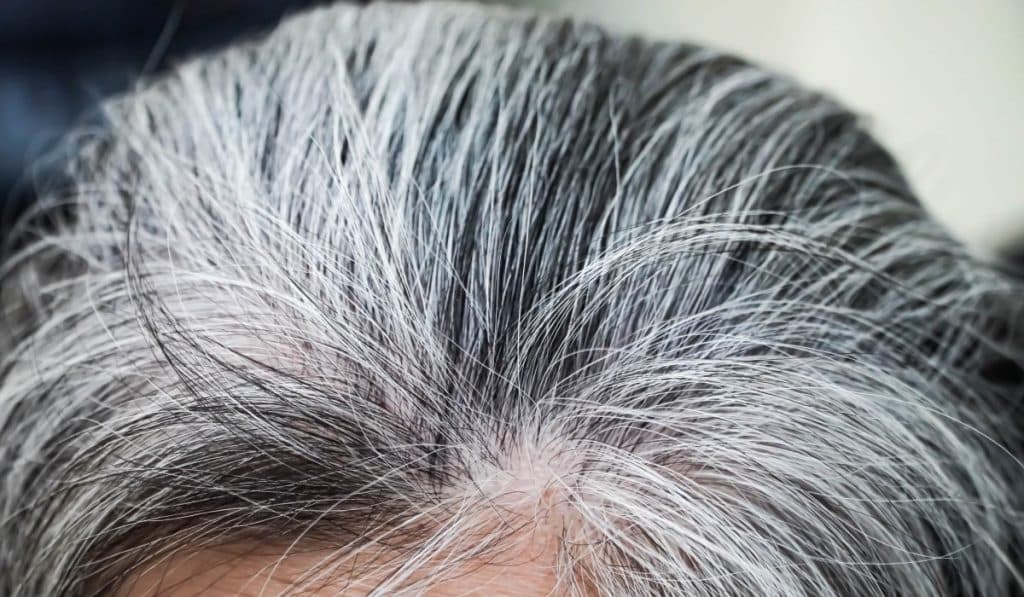 Părul alb la 20 de ani poate fi reversibil! Ce afecțiuni de sănătate pot cauza apariția firelor albe în tinerețe