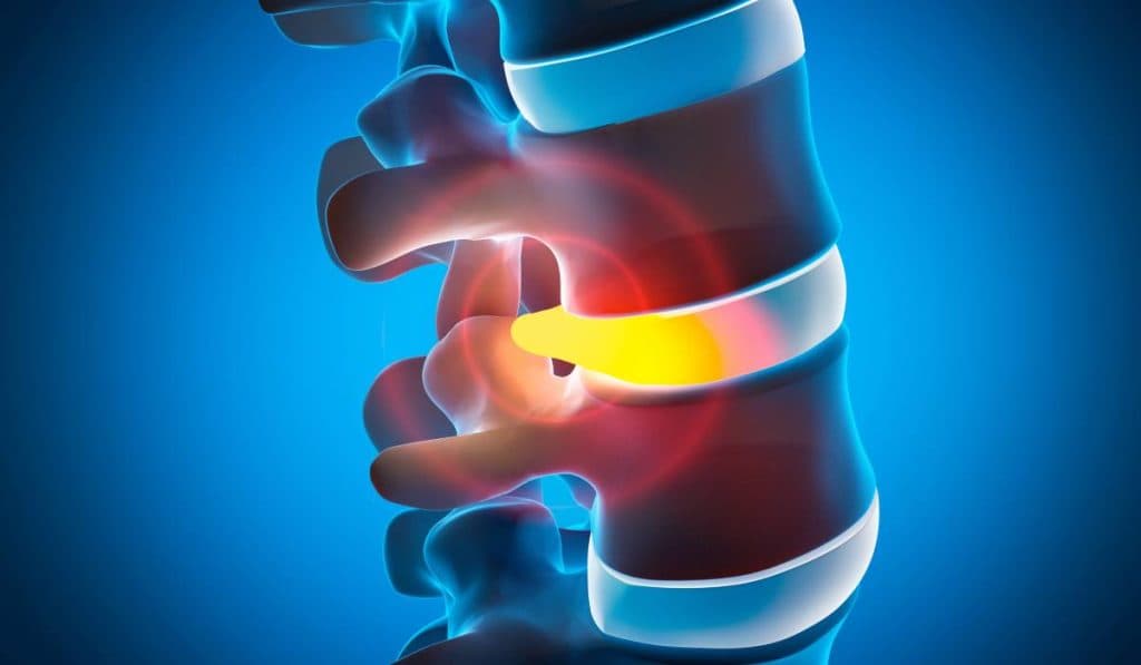 Afecțiuni ale coloanei vertebrale la copii și adolescenți, diagnosticate prin tehnologia CT 3D