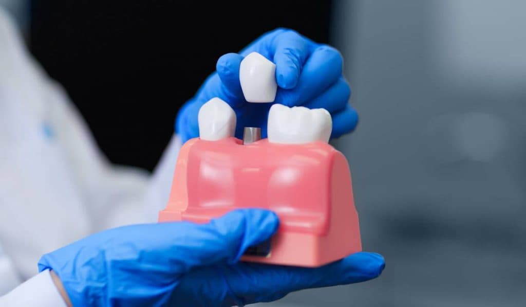 Implantologia dentară, de la A la Z. „Vârsta avansată nu reprezintă un impediment pentru implanturile dentare”