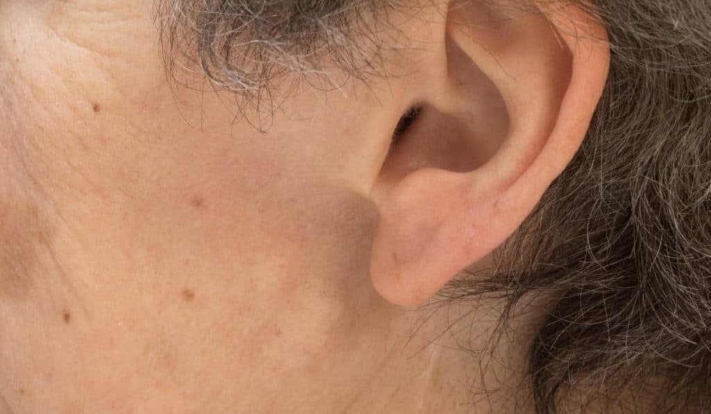 Ce afecțiuni dermatologice pot spori riscul de cancer cutanat. „Este esențial să te supui unei examinări medicale”