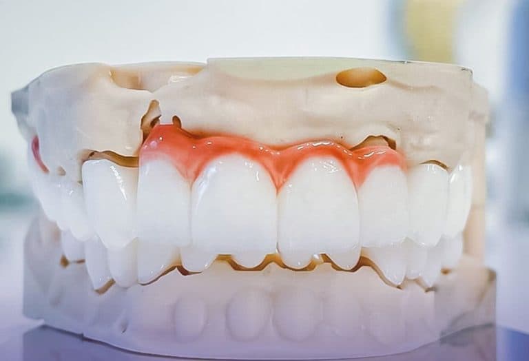 Dinții sensibili la frig? Descoperă cum tratamentele de desensibilizare dentară îți oferă confort.