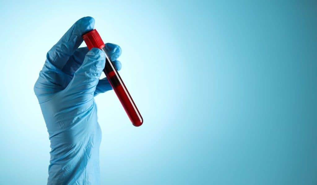 Persoanele cu această grupă de sânge au o predispoziție mai mare de a suferi un infarct înainte de împlinirea vârstei de 60 de ani.