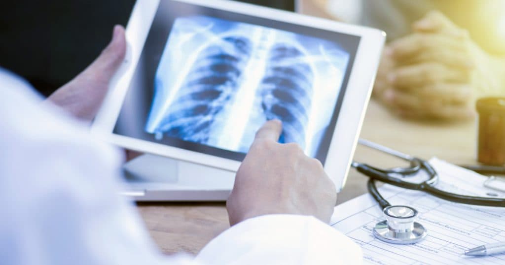 „Pacienții nu își recunosc simptomele”. Tuberculoza provoacă mii de victime în România, dar puțini dintre bolnavi se prezintă la medic la timp.
