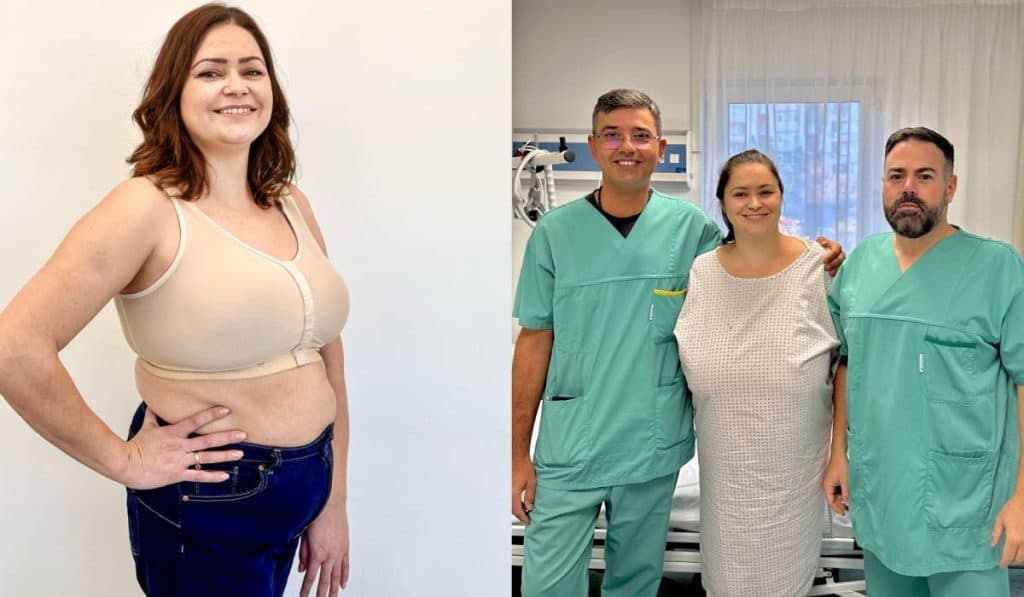 Cazul remarcabil al femeii afectate de gigantomastie. Cum a trecut de la cupa F la cupa C. „Sânii uriași deveniseră o povară!”
