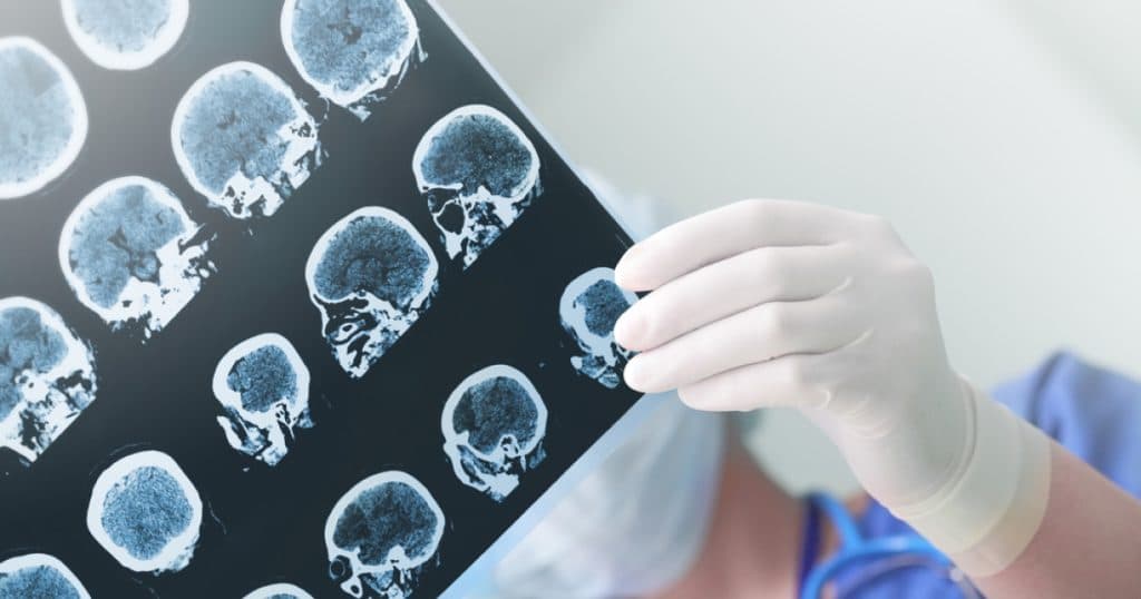 Cum a devenit Parkinson o afecțiune provocată de om. „Nu este doar o chestiune de ghinion”