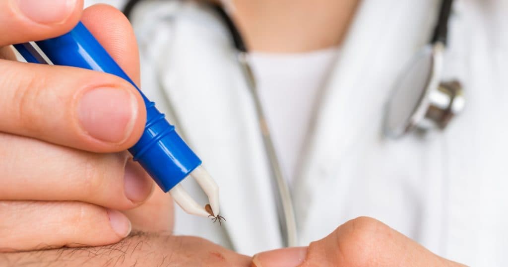 Cum se îndepărtează corect o căpușă și când este necesar să te prezinți la medic. Avertismentul experților: „Evită utilizarea substanțelor pe piele”.