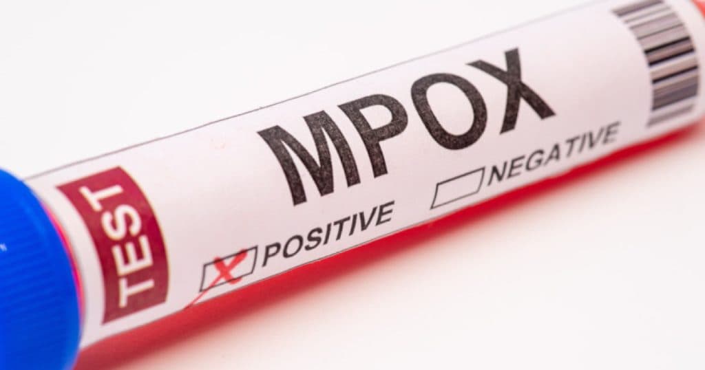 Macedonia de Nord a anunțat primele două cazuri de infectare cu mpox. Autoritățile fac apel către cetățeni.