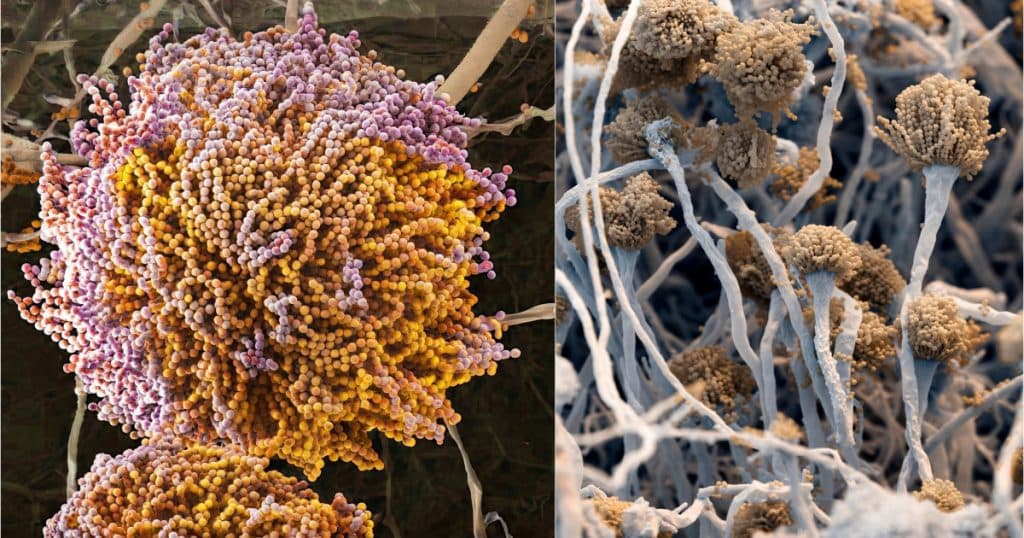 Un nou „supermicrob” mortal prezintă o amenințare globală și se răspândește rapid. Care sunt motivele pentru care infecțiile fungice sunt atât de periculoase?
