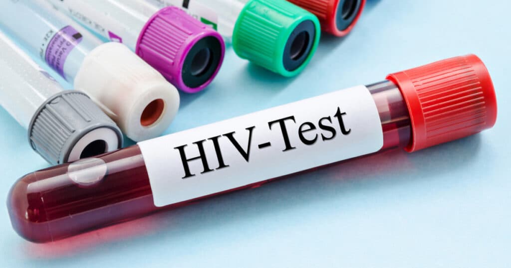 Cercetătorii australieni, „uluți” de efectele unui nou tratament pentru HIV. Descoperirea care ar putea conduce la eradicarea virusului.