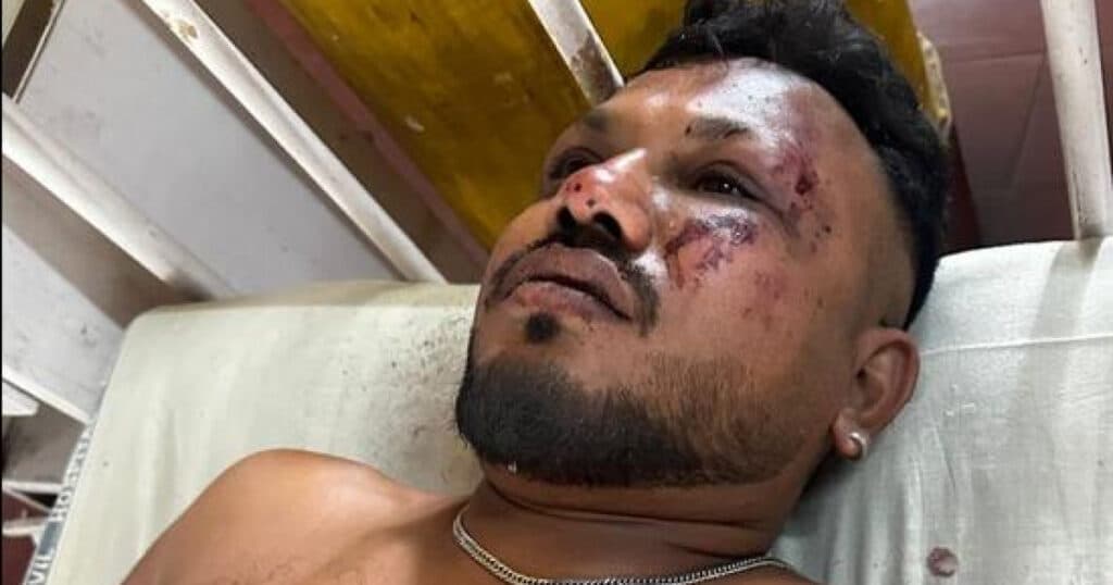Cine este supraviețuitorul accidentului aviatic din India: „Când m-am ridicat, erau cadavre în jurul meu. Mi-a fost frică”