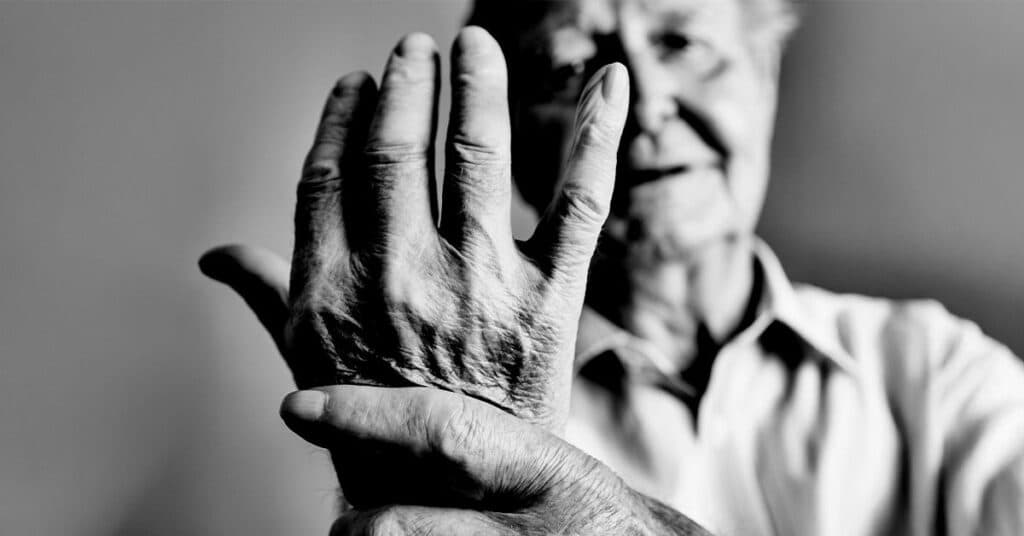 Testele clinice ar putea anticipa cel mai potrivit tratament biologic pentru artrita reumatoidă, adaptat fiecărei persoane.