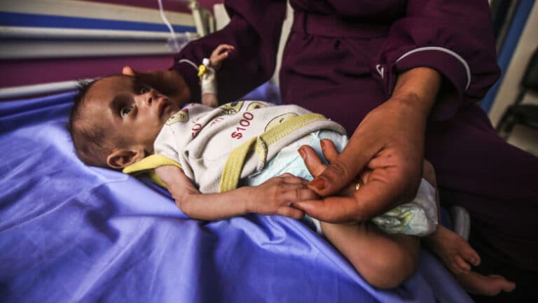„Criza hranei: De trei ori mai mulți copii sub 5 ani suferă de subnutriție în Gaza în ultimele două săptămâni.”