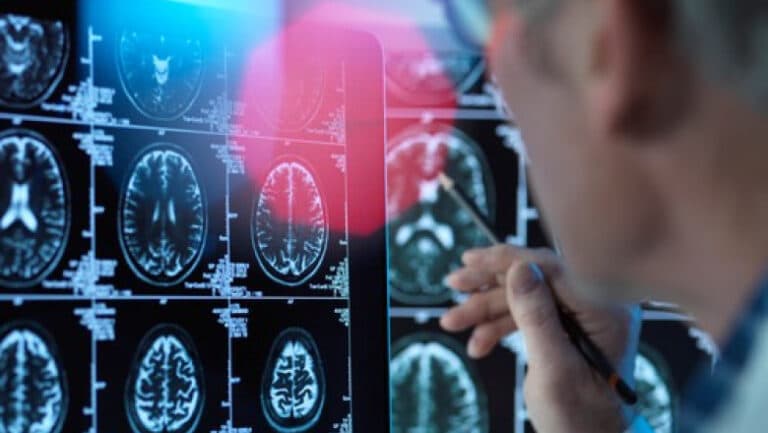 Un nou tratament promițător pentru Alzheimer în stadii incipiente se apropie de aprobatul în Uniunea Europeană: descoperiți donanemab
