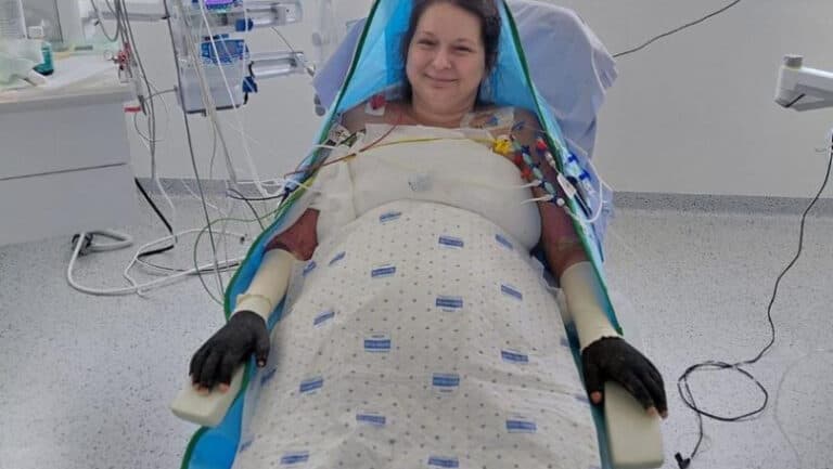Care este evoluția stării de sănătate a Laviniei, pacienta cu arsuri care a fost transferată în Belgia? Mesajul emoționant al surorii sale: „Totul rămâne un mister.”