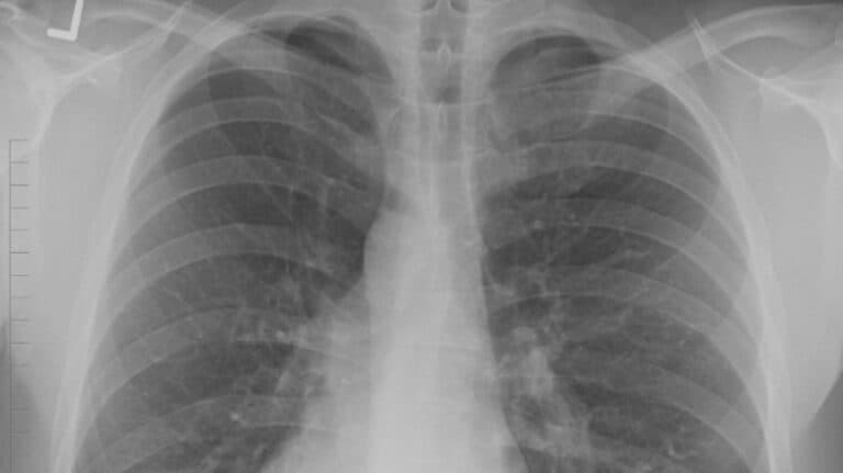 „Descoperă secretele ‘bolii legionarilor’: epidemie cu cinci victime și peste 100 de infectări confirmate.”