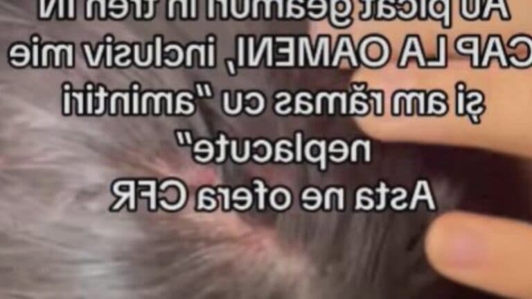 Momente terifiante într-un tren românesc: o mamă și fiica sa de 12 ani au suferit răni din cauza geamurilor sparte în timpul călătoriei