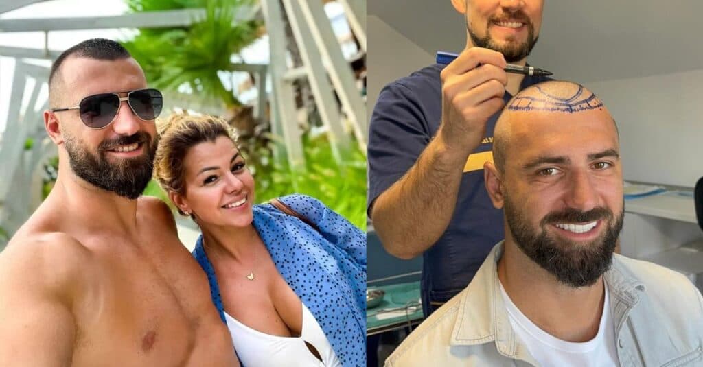 Andrei Stoica, renumitul kickboxer, își transformă look-ul cu un implant de păr: „Sunt pregătit pentru un nou început. Acum este timpul ideal!”