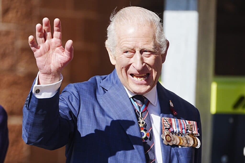 Degetele Regelui Charles, asemănătoare cu niște cârnați, au stârnit un val de reacții! Ce afecțiuni de sănătate se află în spatele acestei imagini surprinzătoare?