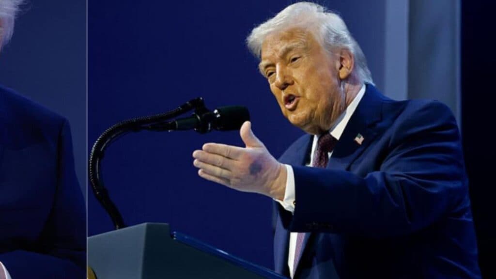 De ce a fost Donald Trump surprins cu o mână umflată la Davos? Descoperă adevărul despre tratamentele sale zilnice: „Nu am nimic de pierdut!”