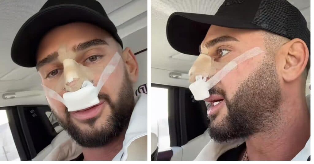 Dorian Popa, în fața unei provocări serioase: „Mă simțeam ca Michael Jackson, cu nasul în pericol.”