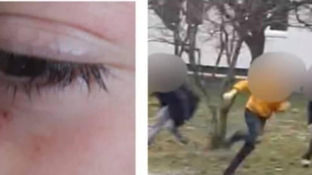 Conflict serios într-o școală din Maramureș: un băiat de 12 ani a fost atacat de două fete. Autoritățile au demarat o investigație